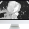 ARRS Radiology Review: Multispecialty Cases 2019 (Videos)