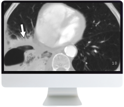 ARRS Radiology Review: Multispecialty Cases 2019 (Videos)