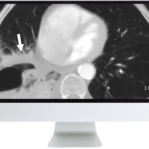 ARRS Radiology Review: Multispecialty Cases 2019 (Videos)