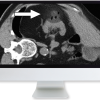 Cross-Sectional Renal Imaging: Techniques and Diagnosis 2020 (Videos)