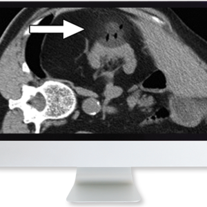 Cross-Sectional Renal Imaging: Techniques and Diagnosis 2020 (Videos)