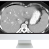 ARRS SAR Disease-Focused Panels: Cancer Imaging and Reporting Guidelines 2021 (Videos)