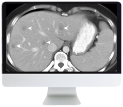 ARRS SAR Disease-Focused Panels: Cancer Imaging and Reporting Guidelines 2021 (Videos)