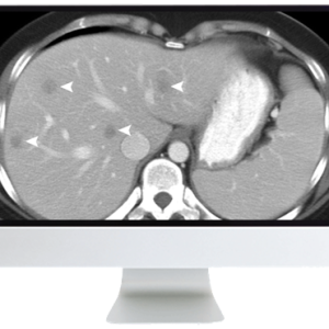 ARRS SAR Disease-Focused Panels: Cancer Imaging and Reporting Guidelines 2021 (Videos)