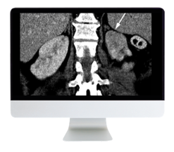 Abdominal and Thoracic Imaging Guidelines Applied: Evidence Versus Opinion 2021 (Videos)