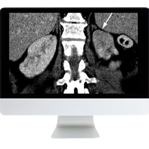 Abdominal and Thoracic Imaging Guidelines Applied: Evidence Versus Opinion 2021 (Videos)