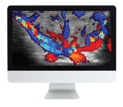 ARRS Thyroid Imaging 2019 (Videos)