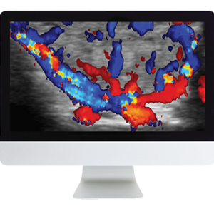 ARRS Thyroid Imaging 2019 (Videos)