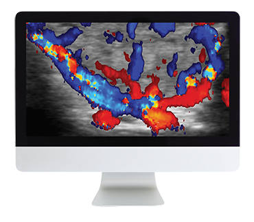 ARRS Thyroid Imaging 2019 (Videos)