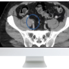 ARRS Venous Disease: Exploration of Advances, Challenges, and Future Directions 2021 (Videos)