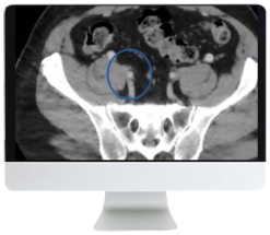 ARRS Venous Disease: Exploration of Advances, Challenges, and Future Directions 2021 (Videos)