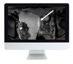 ARRS Women Imaging 2019 (Videos)