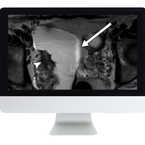 ARRS Women Imaging 2019 (Videos)