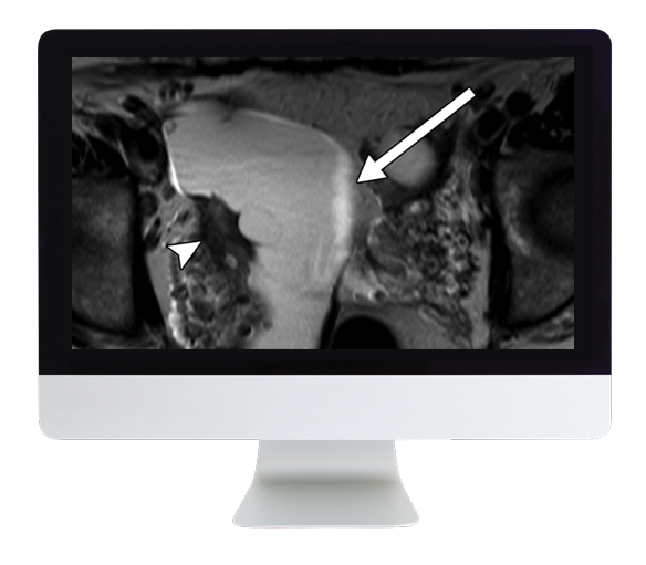 ARRS Women Imaging 2019 (Videos)