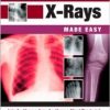 On-Call X-Rays Made Easy