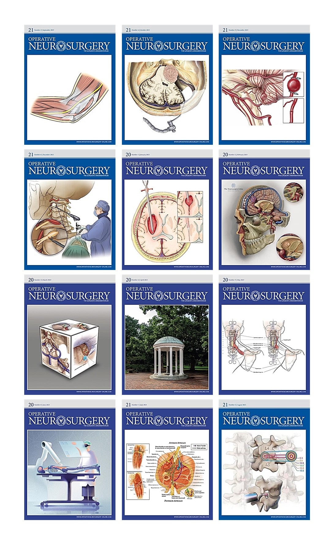 Operative Neurosurgery 2021 Full Archives (True PDF)