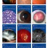 Ophthalmology 2023 Full Archives (True PDF)