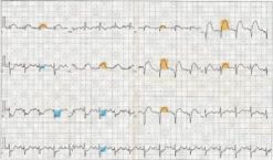 Physician Assistant Care Series – 12 Lead EKG Review (EPUB)