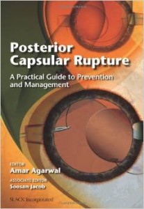 Posterior Capsular Rupture: A Practical Guide to Prevention and Management (ORIGINAL PDF from Publisher)