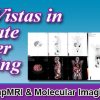 New Vistas in Prostate Cancer Imaging 2022 (Videos)