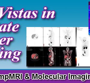New Vistas in Prostate Cancer Imaging 2022 (Videos)