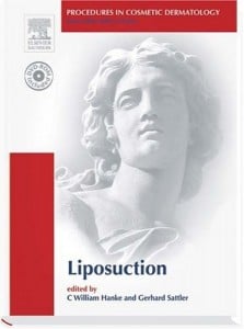 Procedures in Cosmetic Dermatology Series: Liposuction (Original PDF from Publisher)