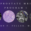 Prostate MRI (Program 1) – John F. Feller, M.D. (CMEScience) (Videos)