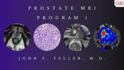 Prostate MRI (Program 1) – John F. Feller, M.D. (CMEScience) (Videos)