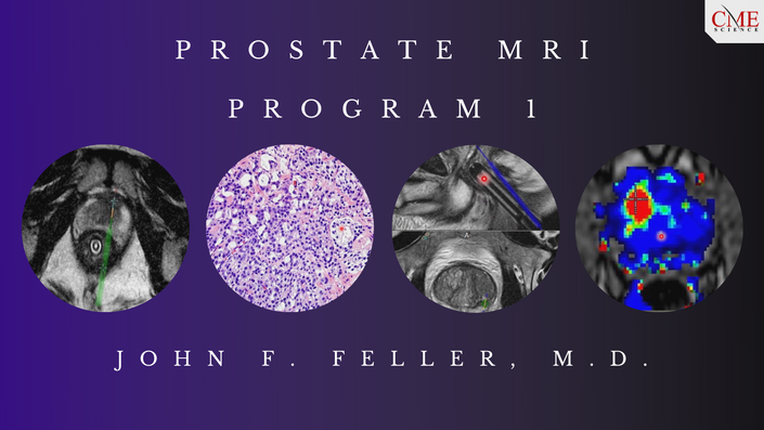 Prostate MRI (Program 1) – John F. Feller, M.D. (CMEScience) (Videos)