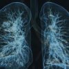 Pulmonary Medicine Board Review Course 2015 (Videos)