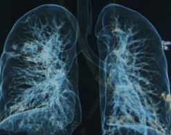 Pulmonary Medicine Board Review Course 2015 (Videos)