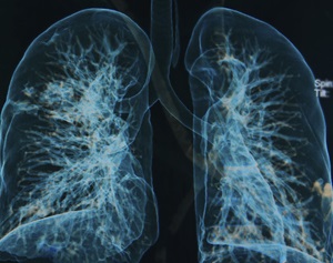 Pulmonary Medicine Board Review Course 2015 (Videos)