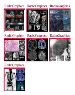 RadioGraphics 2022 Full Archives (True PDF)