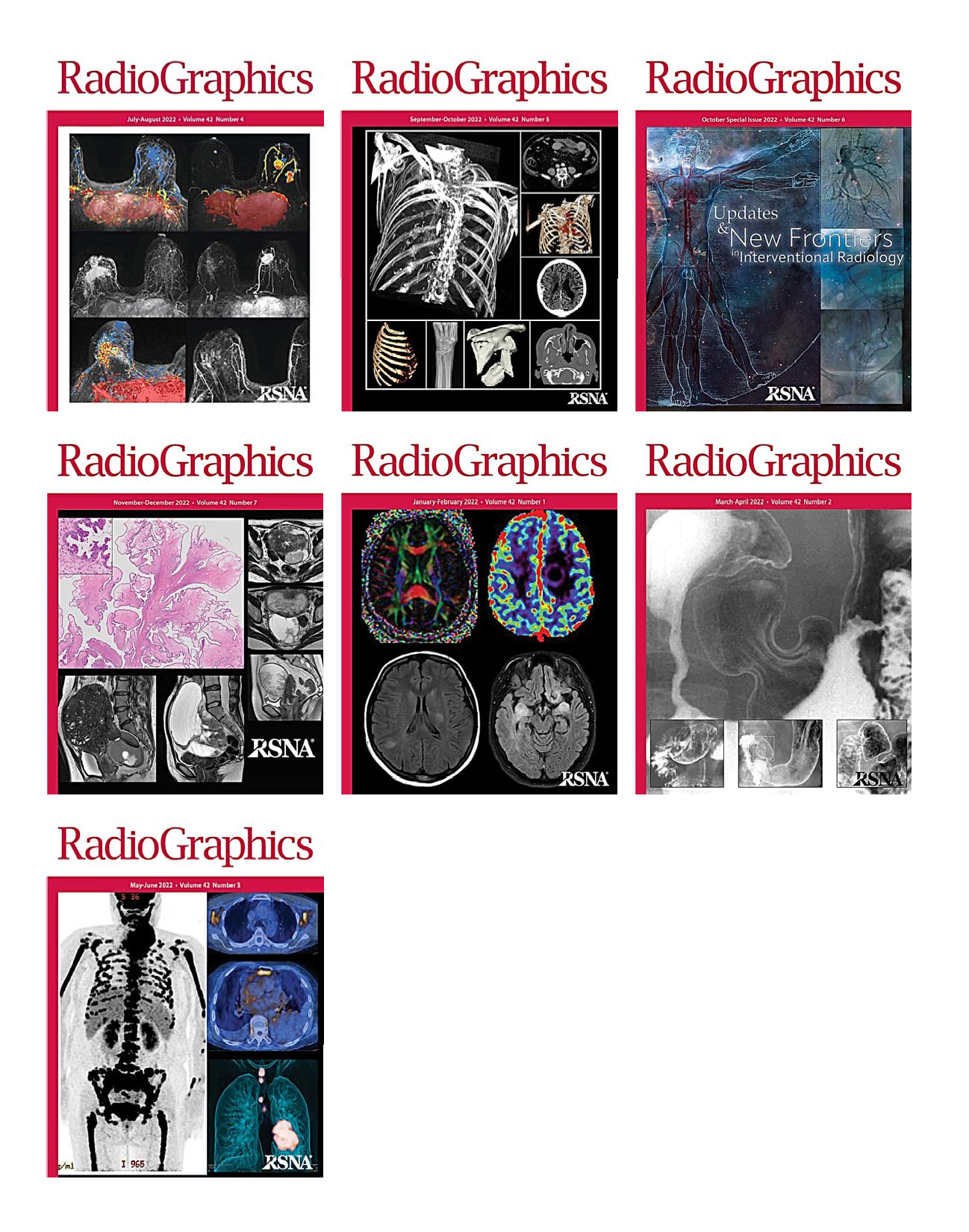 RadioGraphics 2022 Full Archives (True PDF)