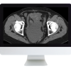 Radiologic Reasoning: A Rapid-Fire Multispecialty Review 2018 (ARRS VIDEOS) (Videos)