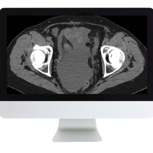 Radiologic Reasoning: A Rapid-Fire Multispecialty Review 2018 (ARRS VIDEOS) (Videos)