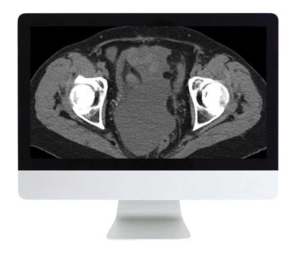 Radiologic Reasoning: A Rapid-Fire Multispecialty Review 2018 (ARRS VIDEOS) (Videos)