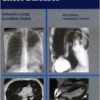 Radiology of Chest Diseases