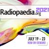 Radiopedia 2021 (July 19 – 23) (Videos, Well Organized)