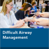 Difficult Airway Management June 2021 (Chestnet) (Videos)