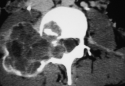 MRI Mastery Series: Degenerative Joint Disease (DJD) 2020 (Videos)