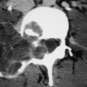 MRI Mastery Series: Degenerative Joint Disease (DJD) 2020 (Videos)