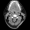 MRIOnline Imaging Mastery Series: Pathology of the Oral Cavity and Oropharynx 2020 (Videos)
