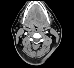 MRIOnline Imaging Mastery Series: Pathology of the Oral Cavity and Oropharynx 2020 (Videos)