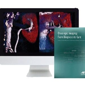 ARRS Oncologic Imaging: From Diagnosis to Cure 2016 (Videos)