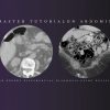 Federle’s Master Tutorial on Abdominal Imaging: How to Develop an Expert Differential Diagnosis using Decision-Support Tools 2021 (Videos)