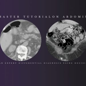 Federle’s Master Tutorial on Abdominal Imaging: How to Develop an Expert Differential Diagnosis using Decision-Support Tools 2021 (Videos)