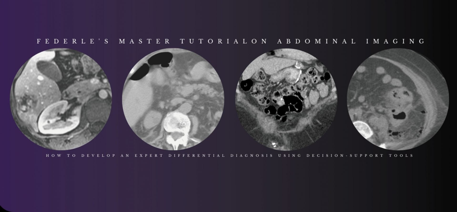 Federle’s Master Tutorial on Abdominal Imaging: How to Develop an Expert Differential Diagnosis using Decision-Support Tools 2021 (Videos)