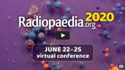 Radiopaedia 2020 – Virtual Conference (Videos)