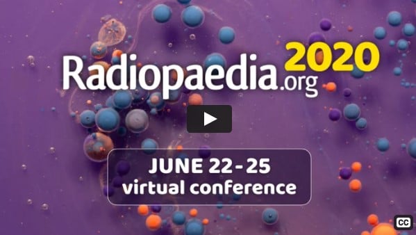 Radiopaedia 2020 – Virtual Conference (Videos)